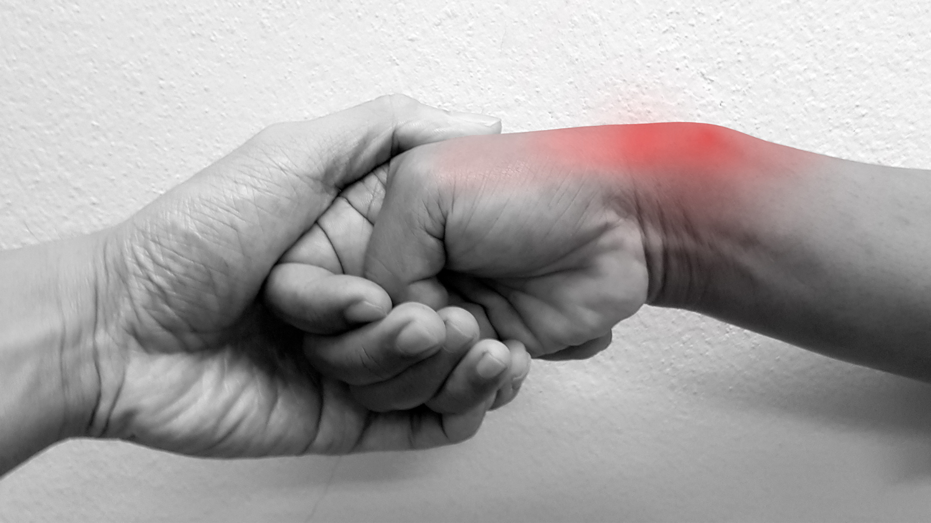 De Quervain’s Disease